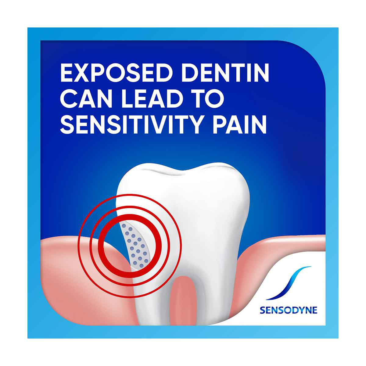 Sensodyne Extra Whitening Sensitive Teeth Toothpaste, 2.7 oz